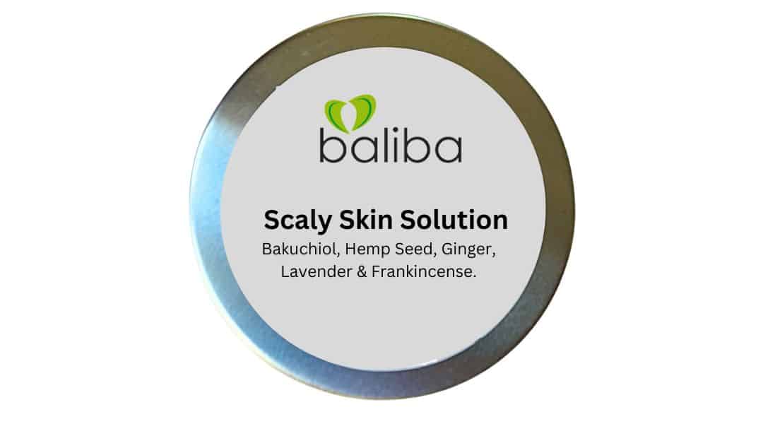 Scaly Skin Solution 90g