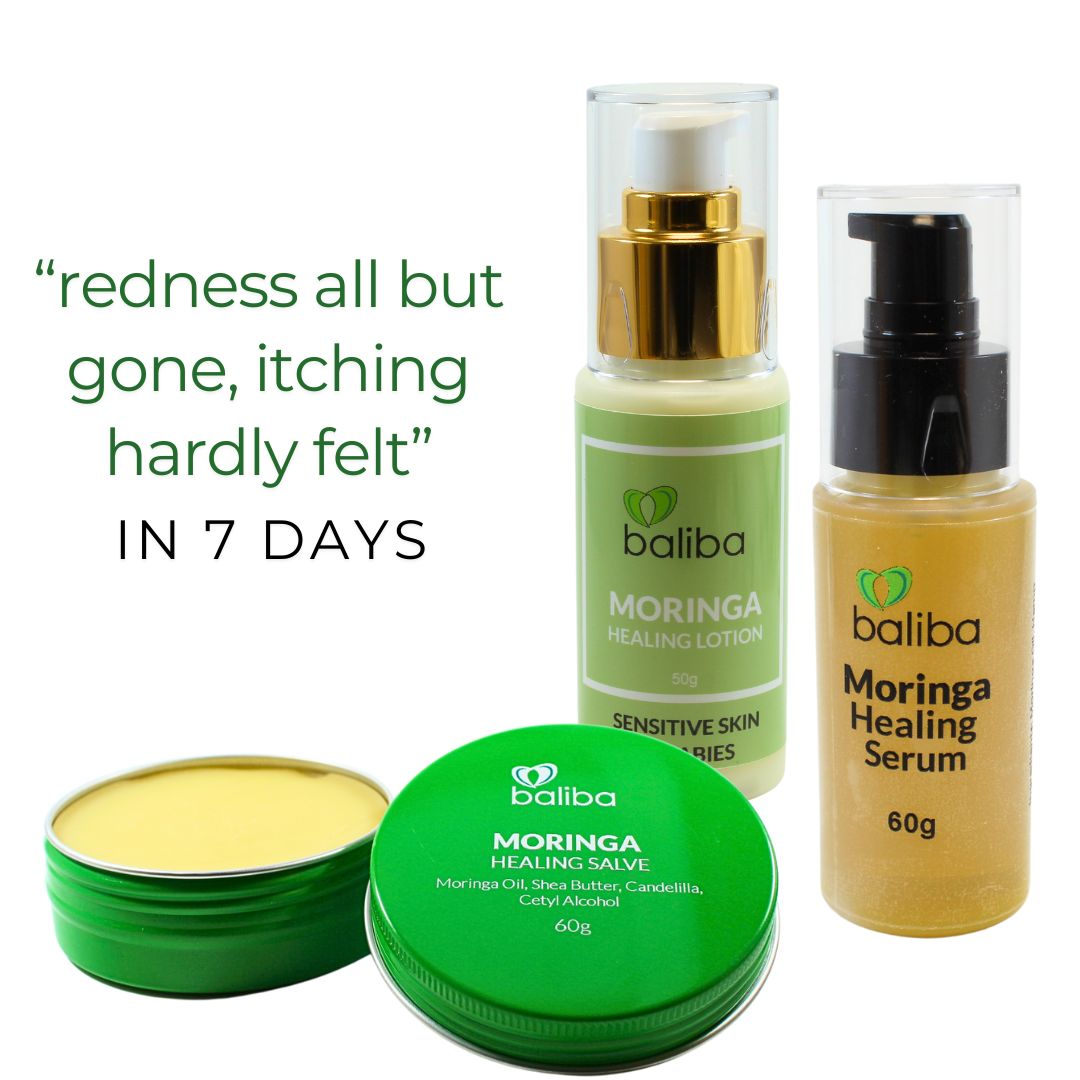 redness all but gone, itching hardly felt Magnesium Body Butter